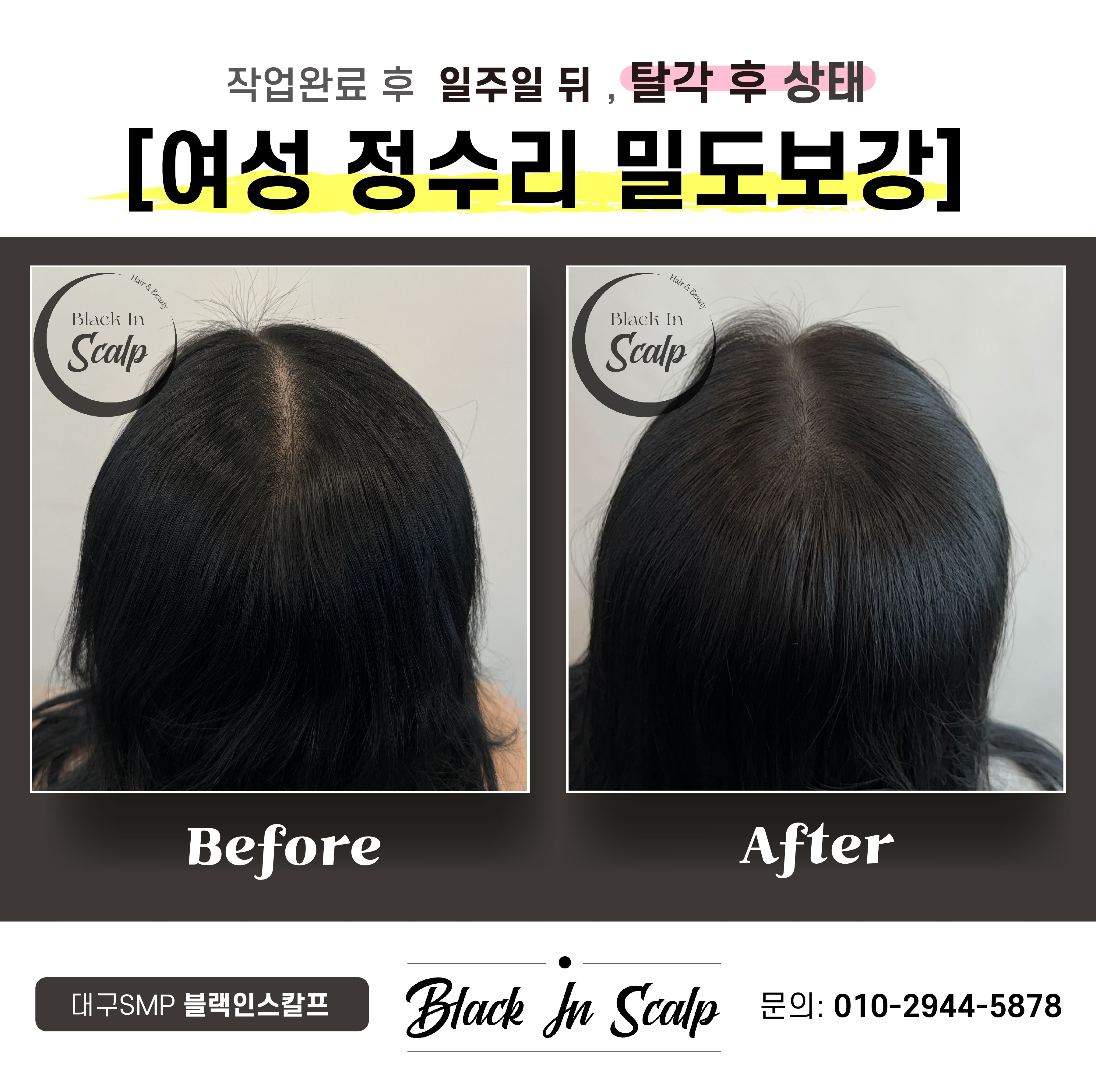 블랙인스칼프 이미지