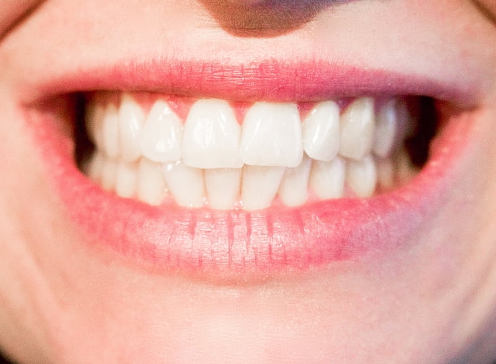 구강유산균과 치아 건강의 관계