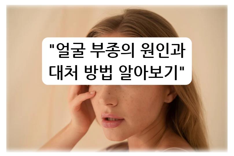 얼굴 부종의 원인과 대처 방법 알아보기