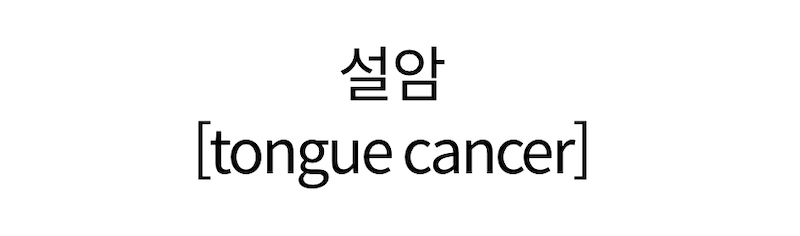tongue cancer 설암