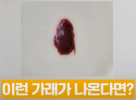 가래 색깔 별 증상과 몸 상태