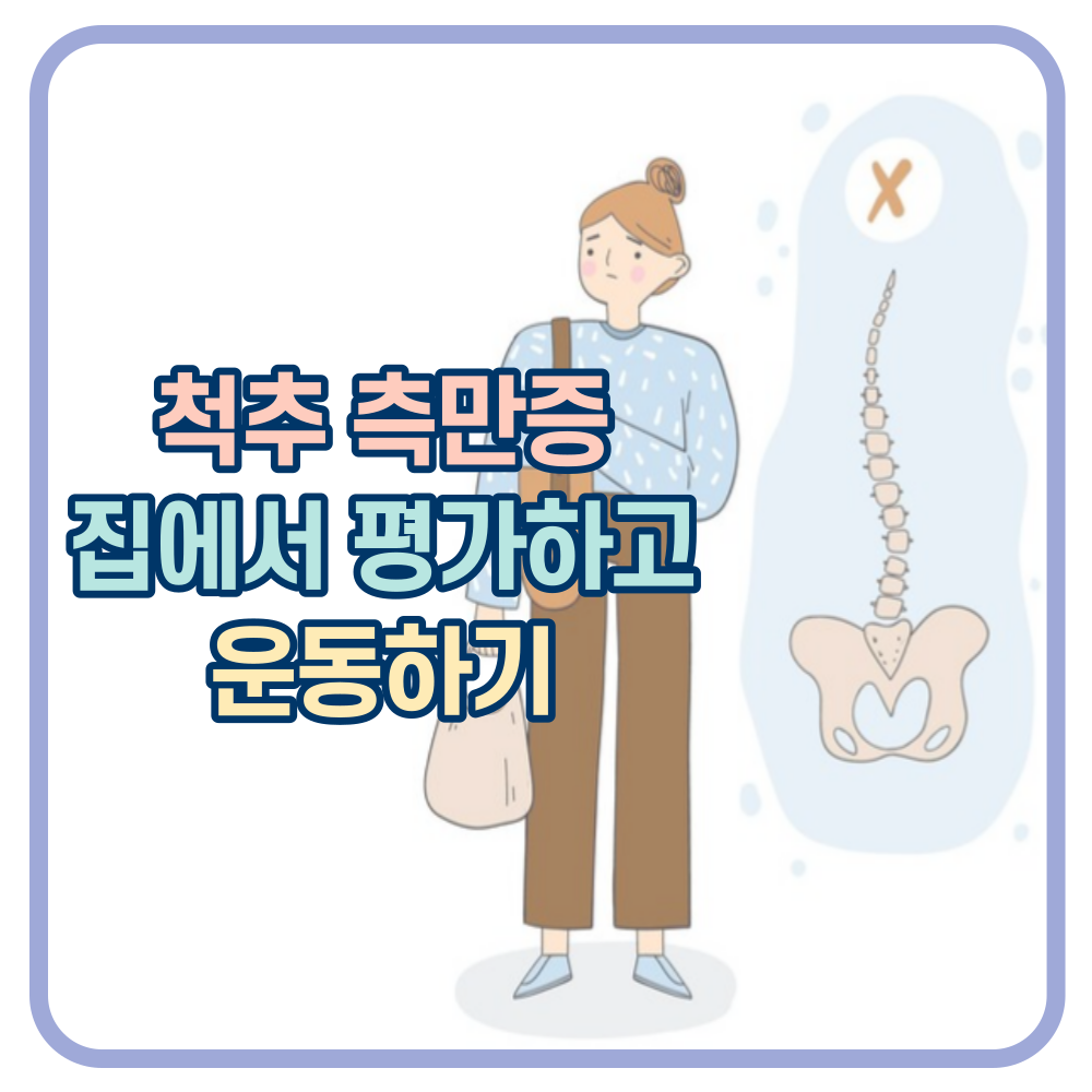 청소년기 척추 측만증. 가정에서 평가하고 운동하기