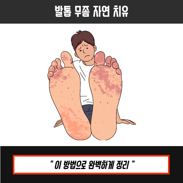 발톱 무좀 자연 치유