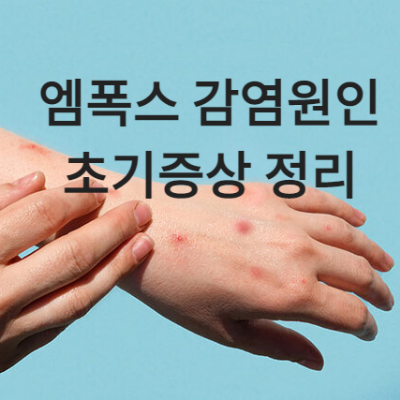  [ 엠폭스 감염원인 ] 엠폭스 감염, 동성애와 관련이 있나?