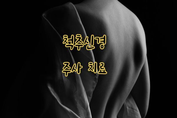 척추신경 주사 치료