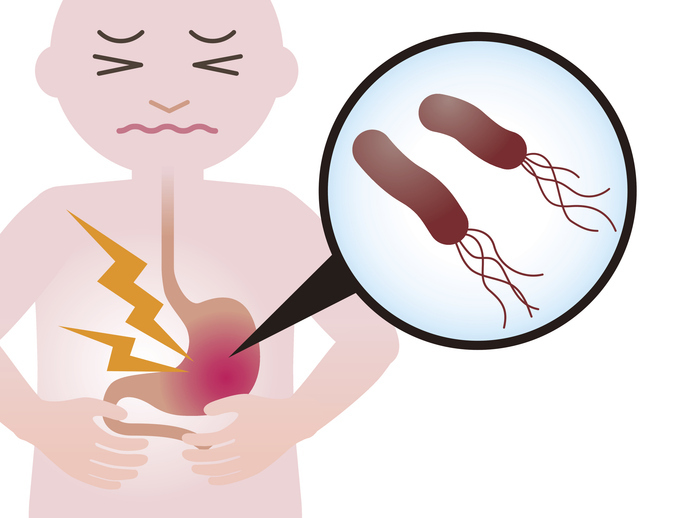 위염과 위암을 유발하는 헬리코박터 파일로리입니다.