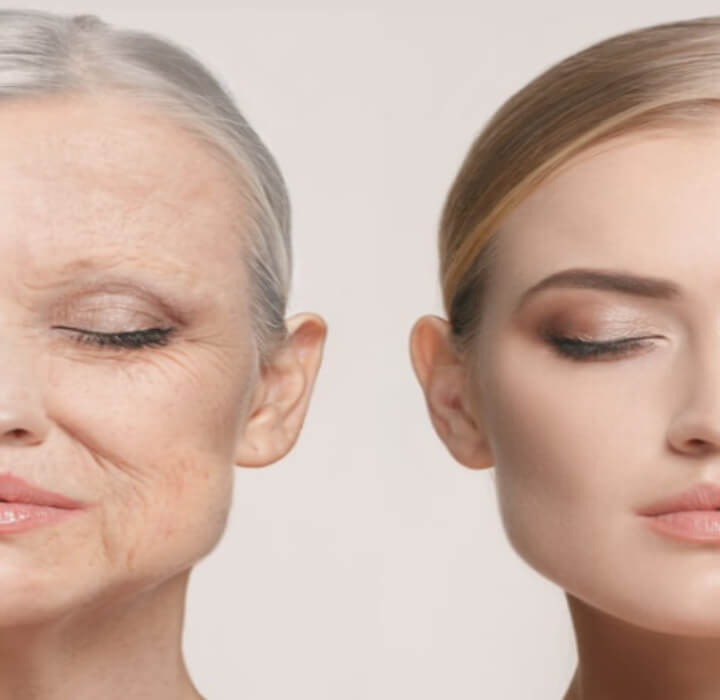 젊은여성과-노인의-피부-비교사진
