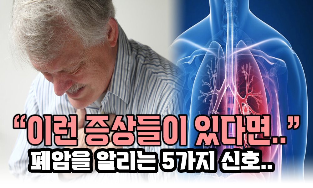 폐암의 전조 증상 5가지