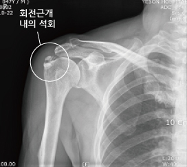 어깨랑 이미지