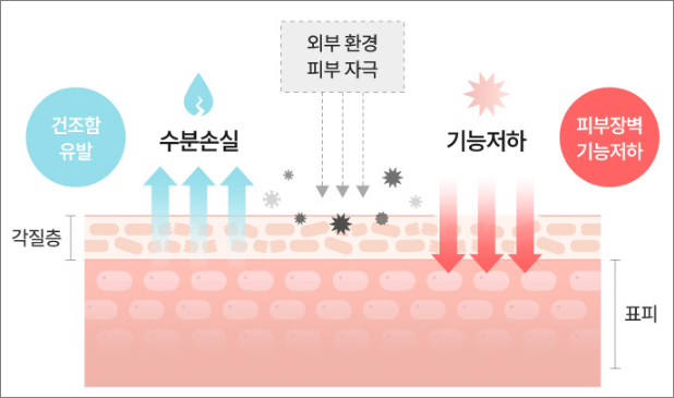 아기피부장벽