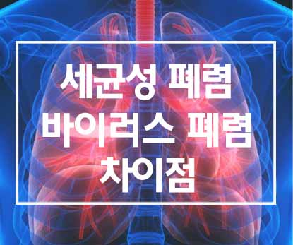  바이러스성 폐렴과 일반(세균성) 폐렴의 차이점