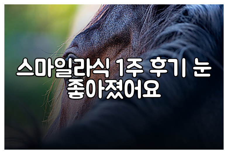 스마일라식 1주 후기 눈 좋아졌어요