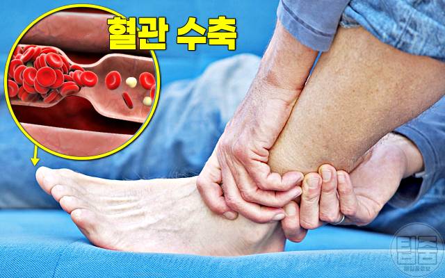 혈관에 좋은 과일 혈행개선제 음식 추천