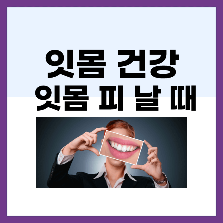  잇몸에 피가 날 때 예방 및 치료 방법을 알아보자