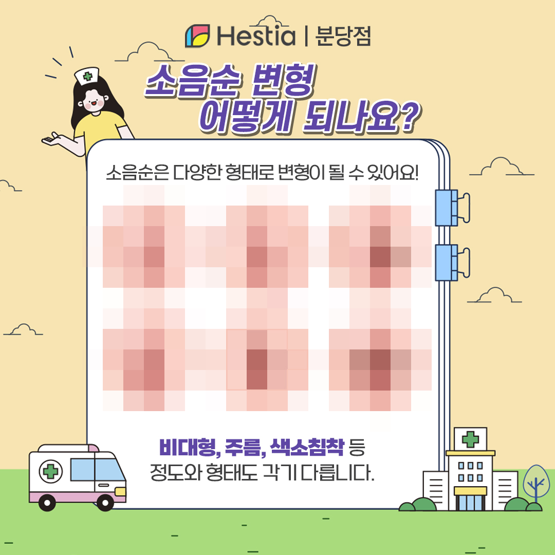 소음순비대증 수술비용 정자역산부인과 여자 생식기 가려움 연고 소음순 변형 나는?