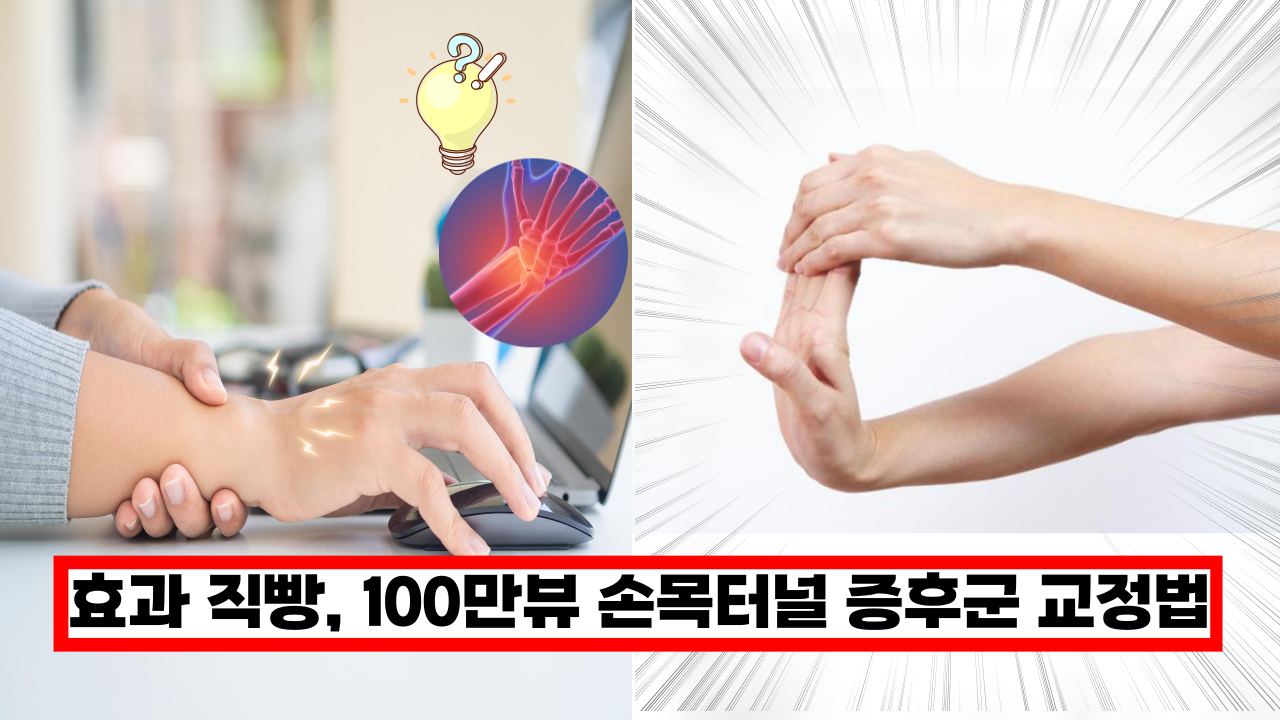  '화제의 100만뷰 손목터널 증후군 교정법' 진짜 효과하나는 직빵임 ㅎㄷㄷ