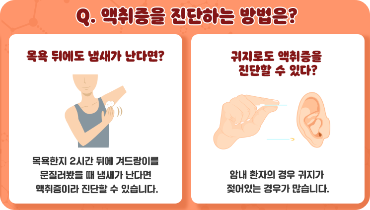 땀냄새수술비용2