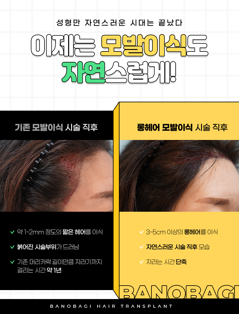 생각 생착률도 해보고 20