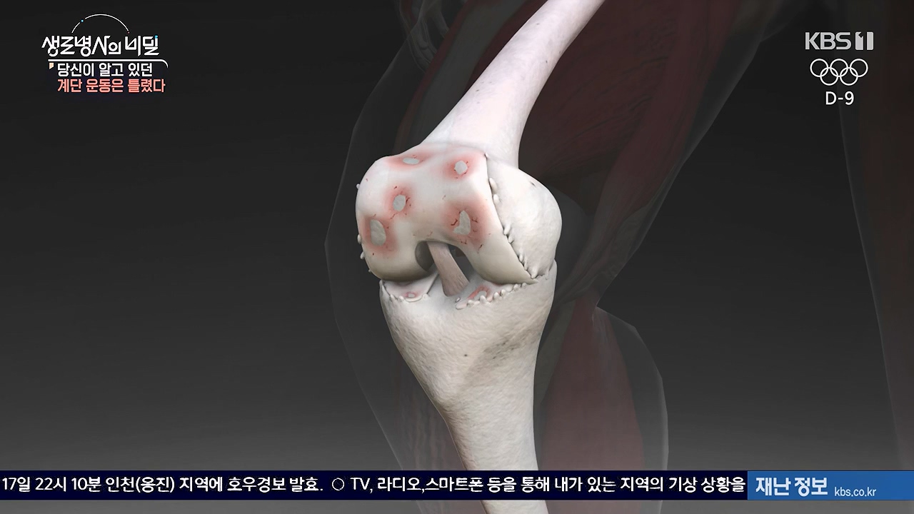 생로병사의 비밀.E920.240718p-NEXT.mp4_20240718_201547.593.jpg
