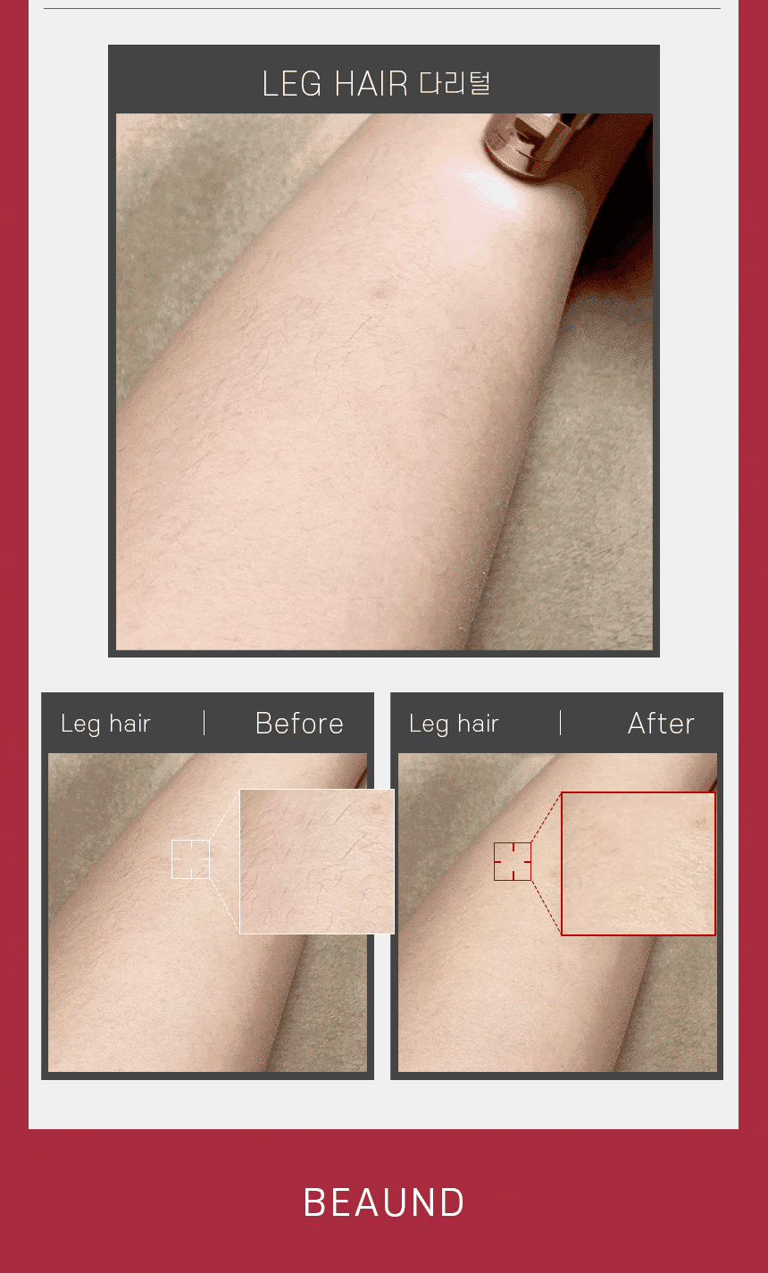 비포애프터-다리