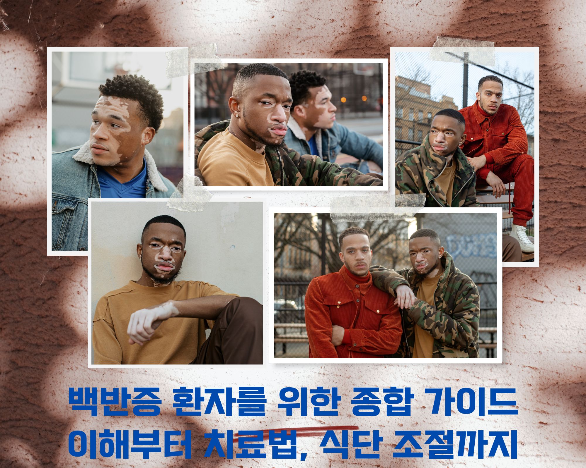  백반증 증세를 보이는 아이들을 위한 종합 가이드: 이해부터 치료법, 식단 조절까지