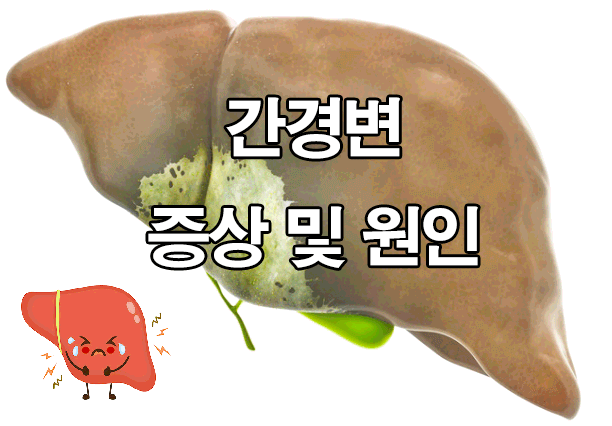  간경변 증상 및 원인 : 치료, 간염