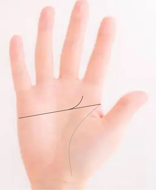 일자손금에 상향하는 가지선