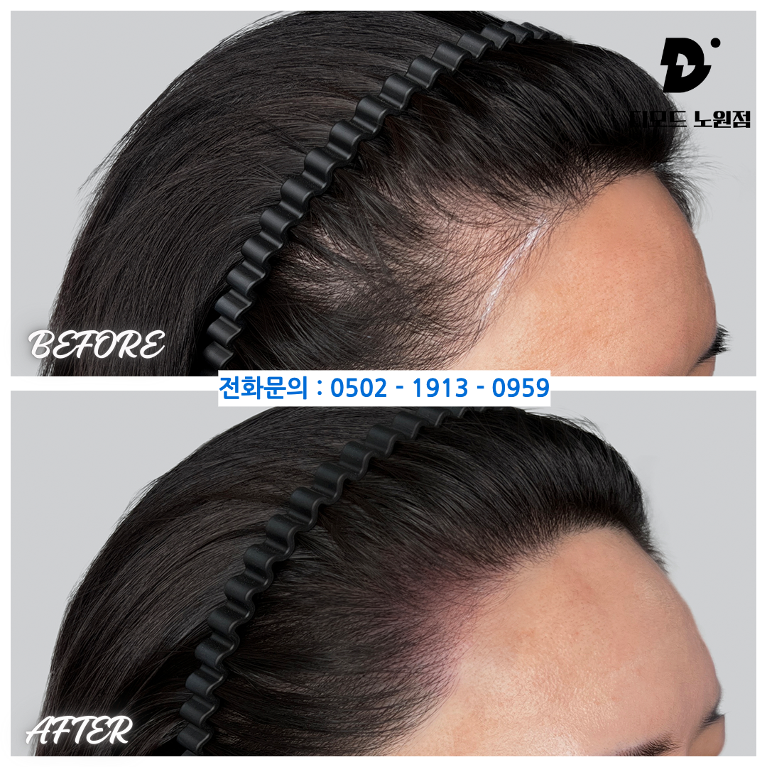 모드라인 이미지