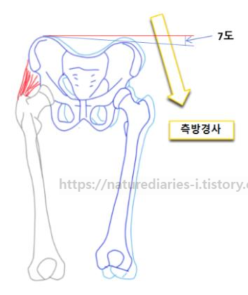 보행의 결정요인(Determinants of gait): 6가지의 특유한 운동 반대측 골반의 측방경사