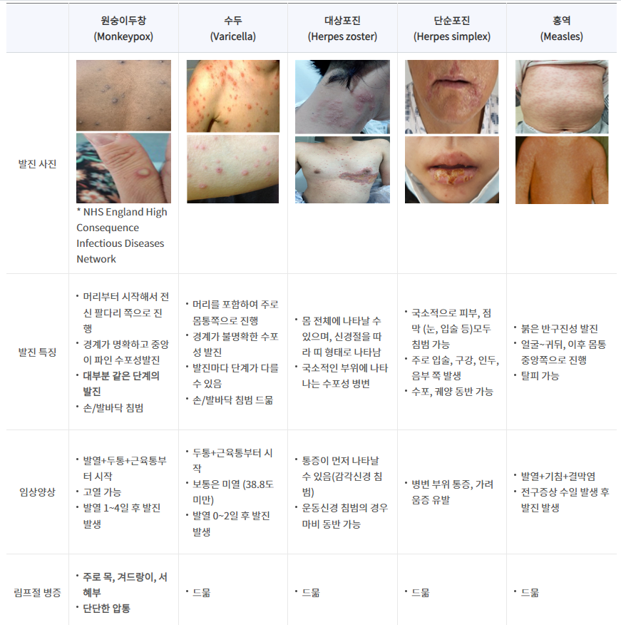 mpox(monkey pox)와 다른 피부질환의 차이점 (질병관리본부)