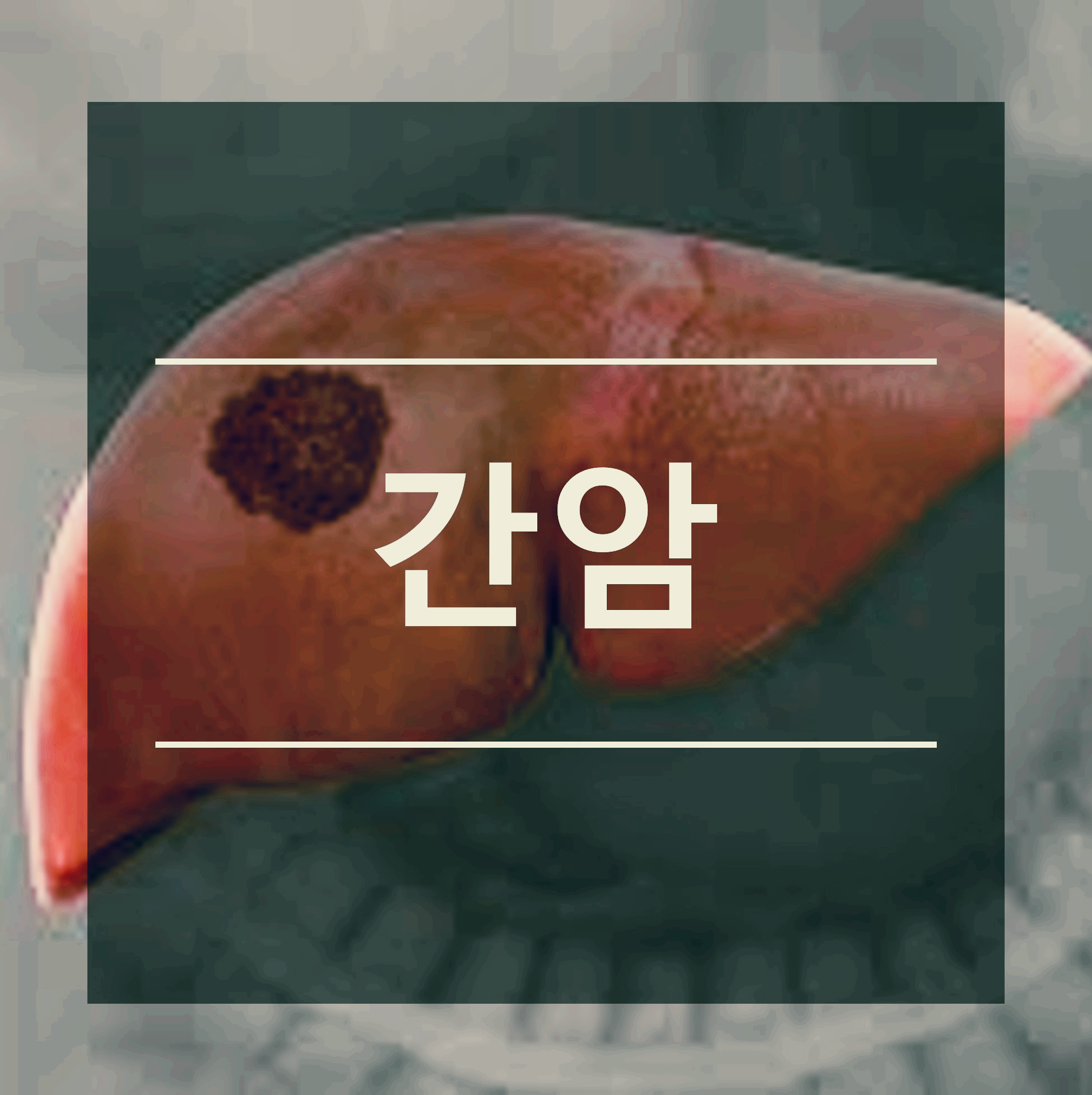 간암 기본정보