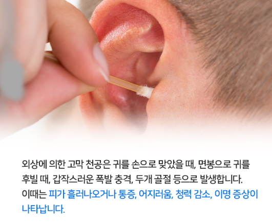 외상성 고막 천공 증상