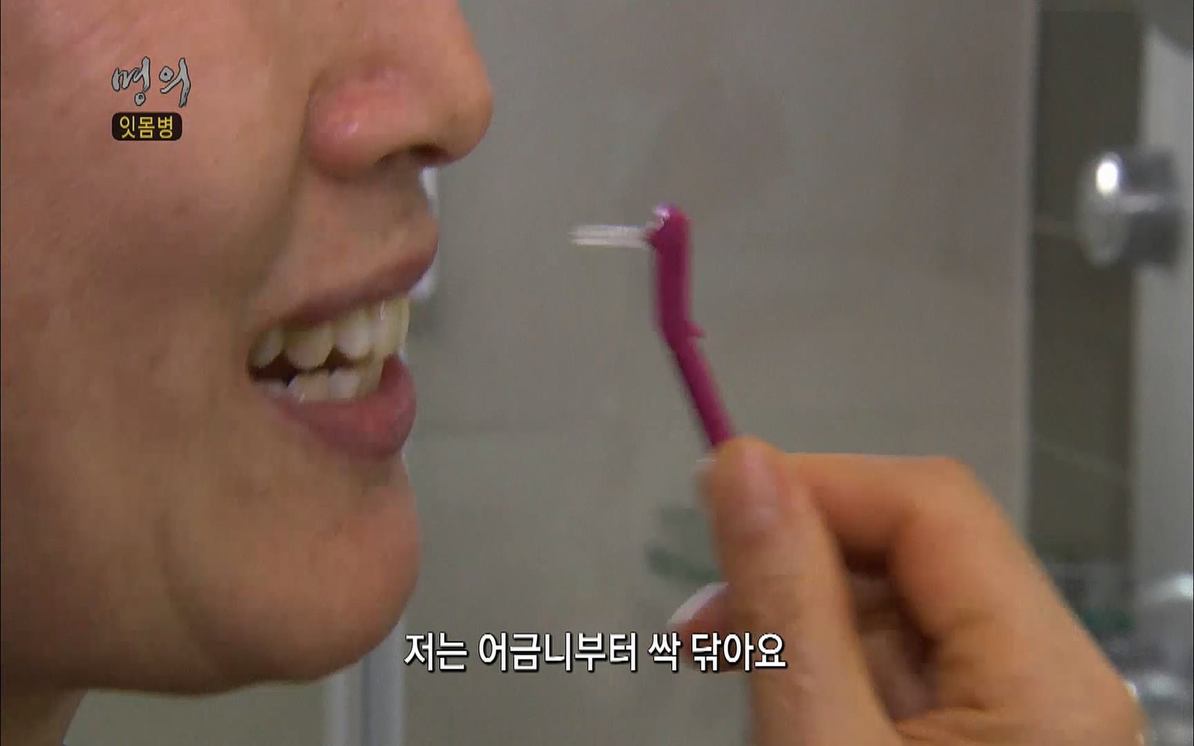 EBS 명의 헬스케어 - TV - 교육의 중심 EBS2015년 1월 16일 (금) 밤 9시 50분, EBS1.mp4_20220505_150416.459.jpg