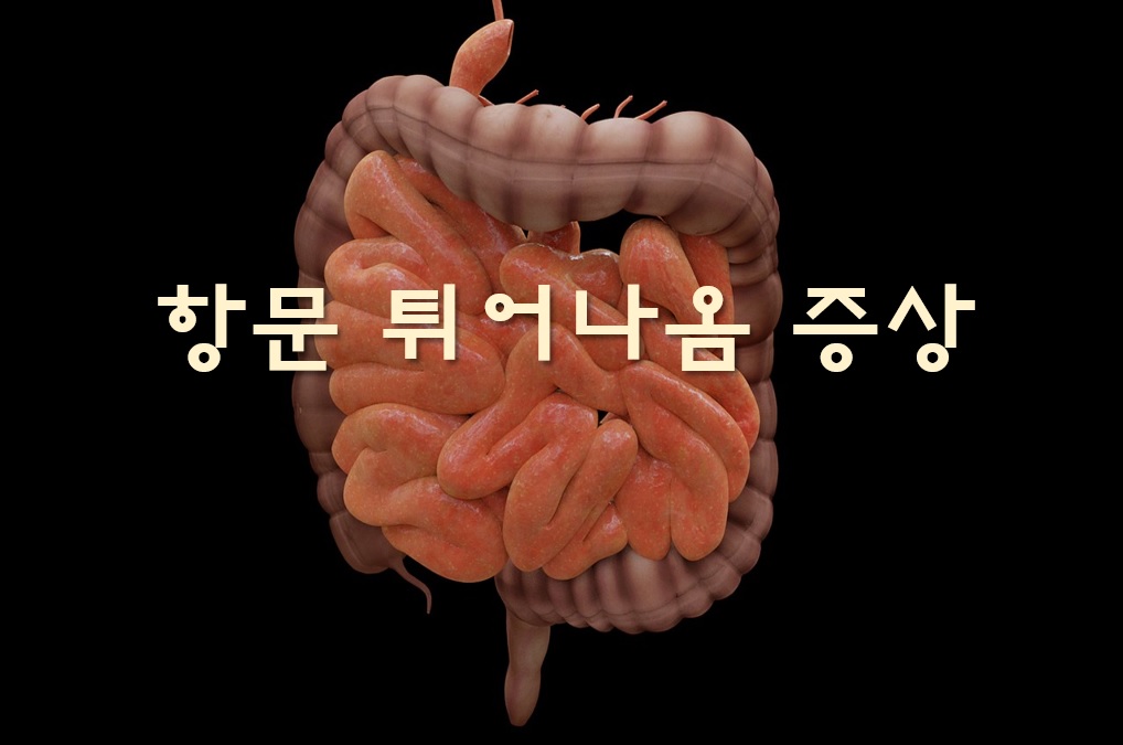  항문 튀어나옴 증상과 항문 종기 치료법