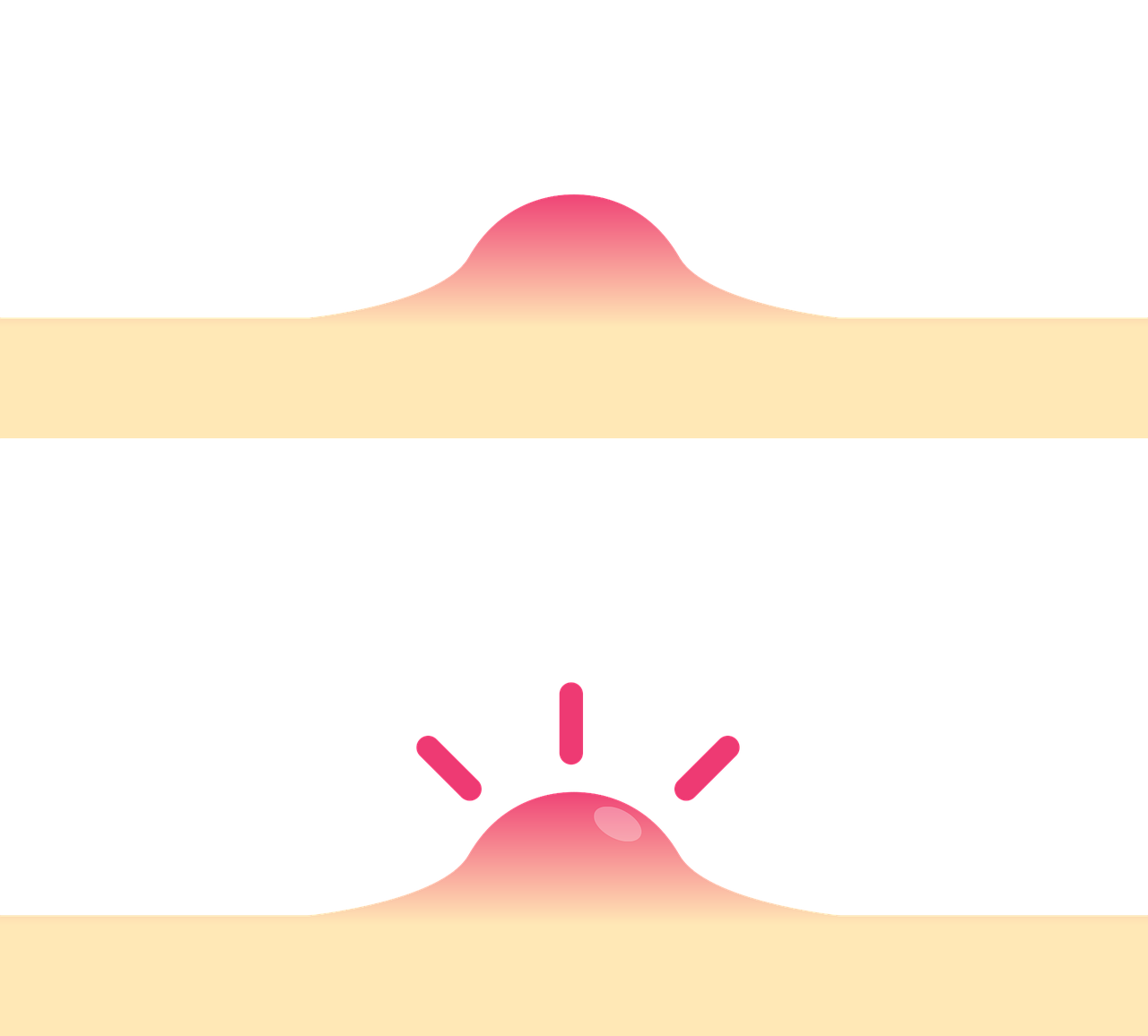 대상포진의 증상,치료와 예방법 1