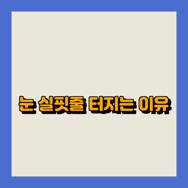 이유엔 이미지