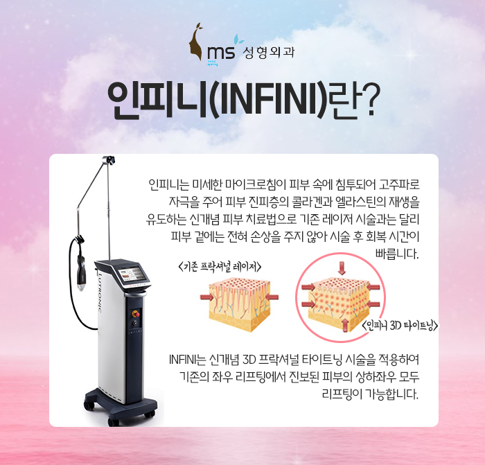 인피니 이미지