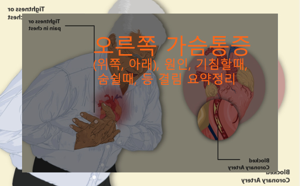 오른쪽 가슴통증(위쪽, 아래), 원인, 기침할때, 숨쉴때, 등 결림 요약정리