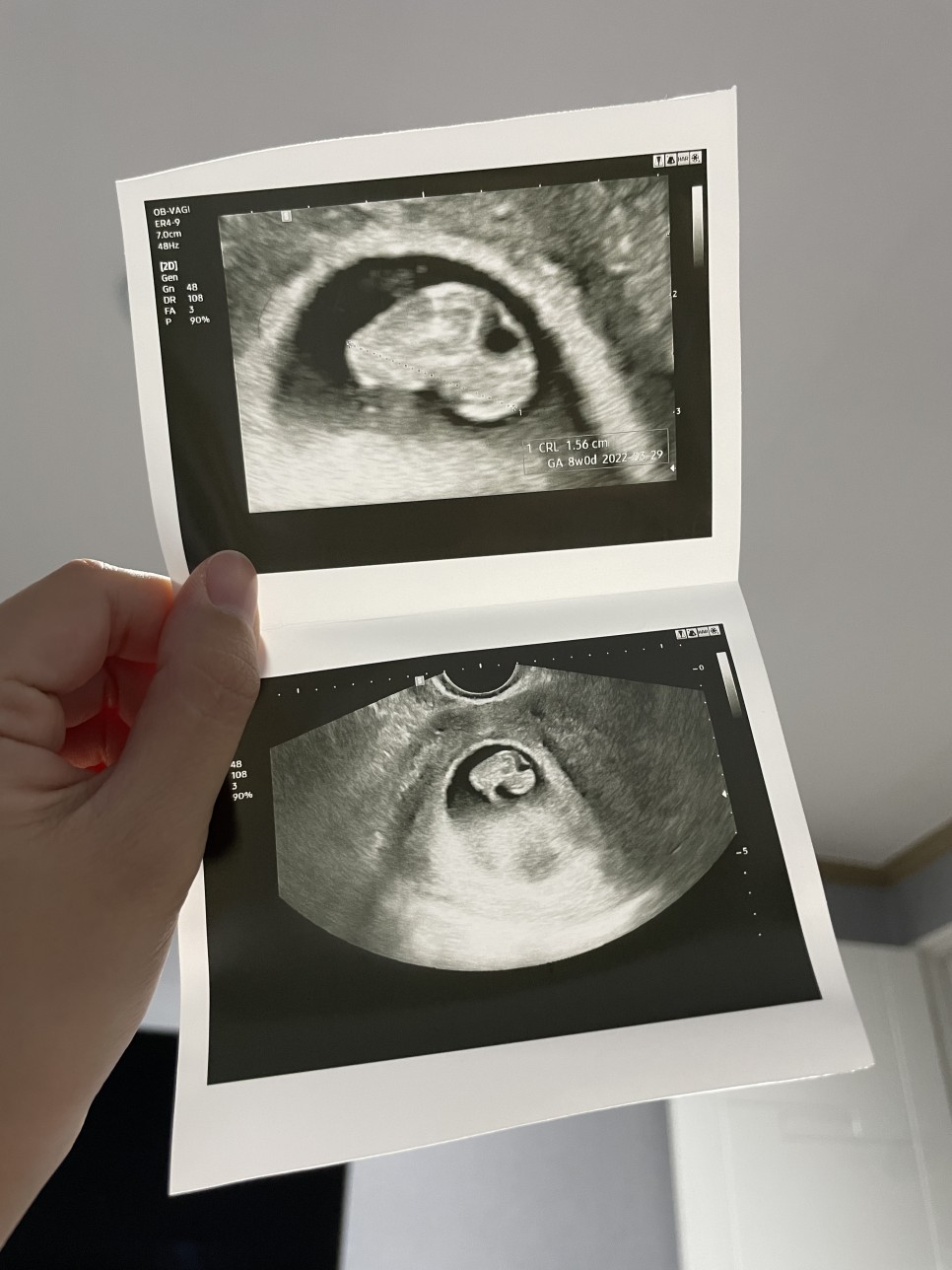 임신8주:: 동탄제일병원 / 산전검사 결과 / 임산부 갑상선 수치 5