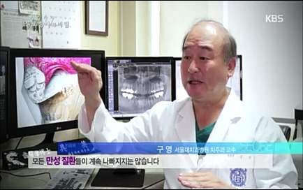 [670회] 생로병사의 비밀 - KBS670회] 생로병사의 비밀.ts_20220505_141935.261.jpg