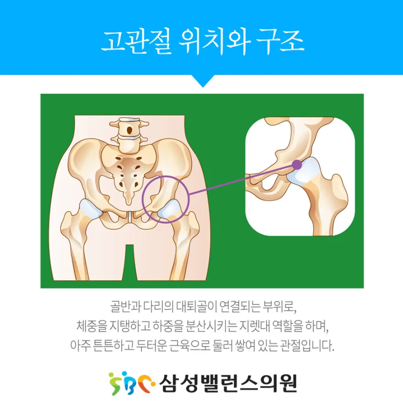 고관절 통증 증상 확인하기_3