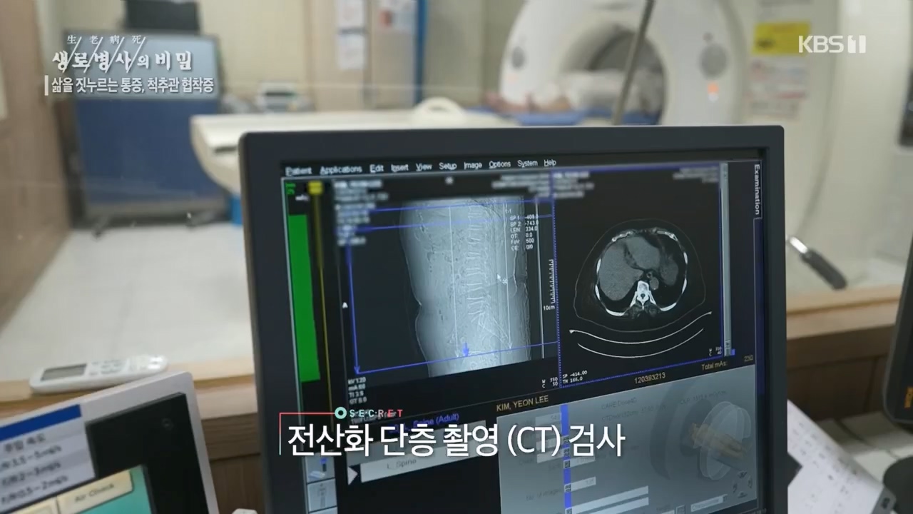 생로병사의 비밀.E866.230427p.H264-F1RST.mp4_20230427_202711.858.jpg