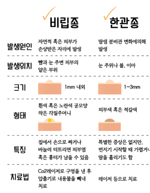 비립종과 한관종