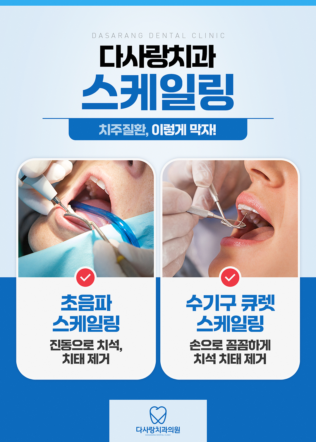  정릉치과 내 치아를 보존하는 치료를!