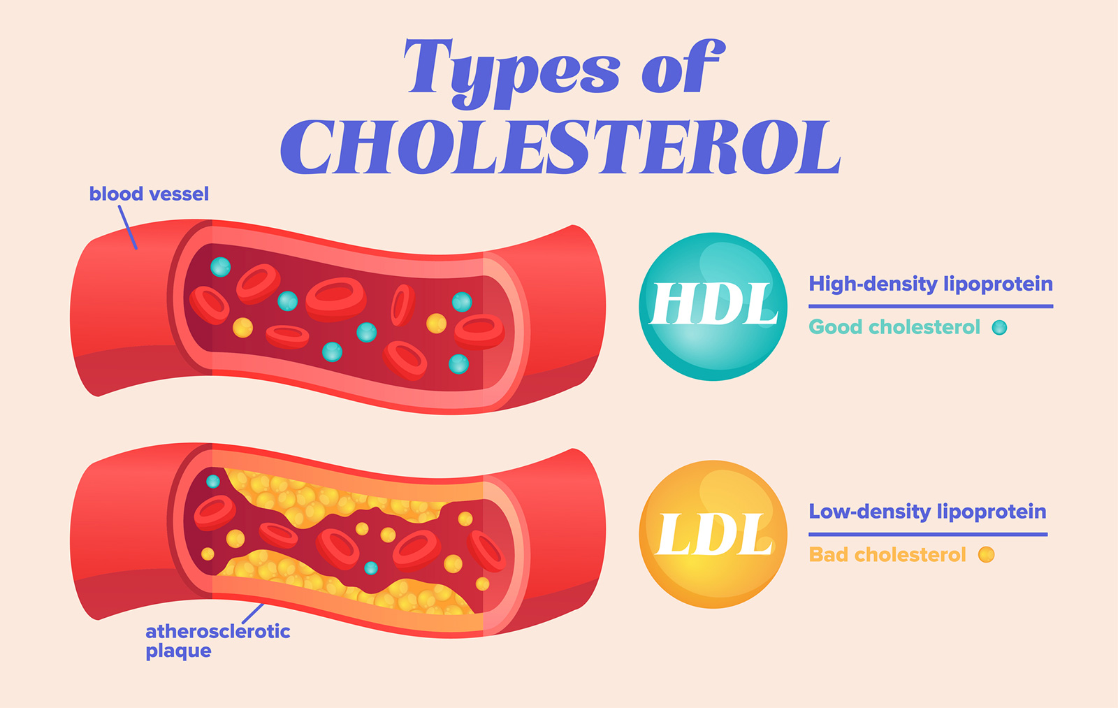 HDL LDL