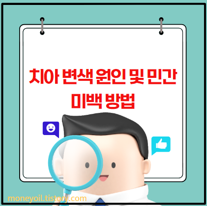 치아 변색 원인 및 민간 미백 방법