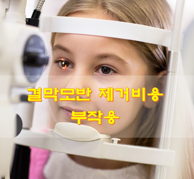  결막모반 제거비용 부작용