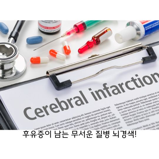  뇌경색 원인을 파악하고 후유증을 최소화 해야!