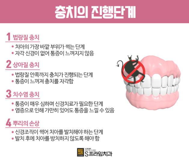 에스프라임 이미지