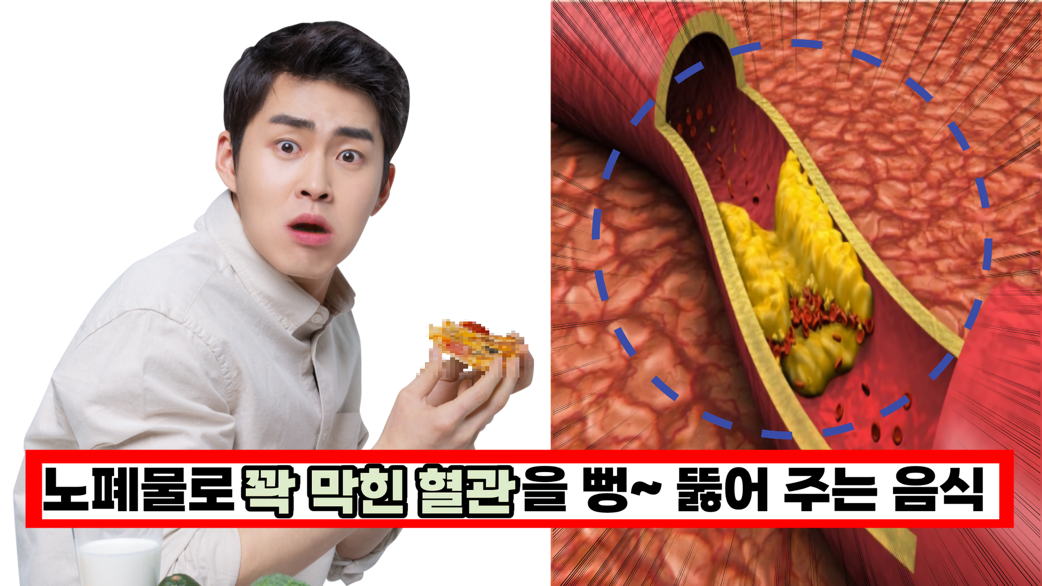  노폐물로 꽉 막힌 혈관을 뻥~ 뚫어 주는 음식 3가지